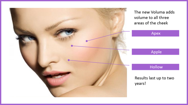 Use of hyaluronic acid fillers for the treatment of the ...